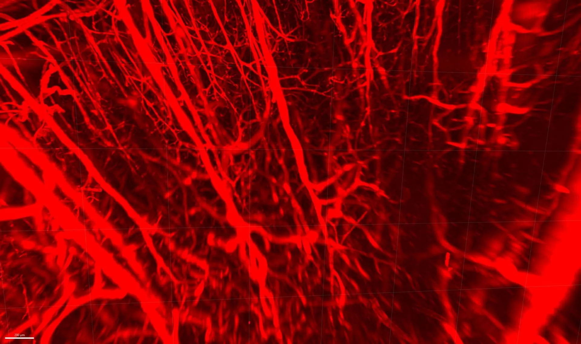Densely branching brain blood vessels labelled in red fluorescence against a black background