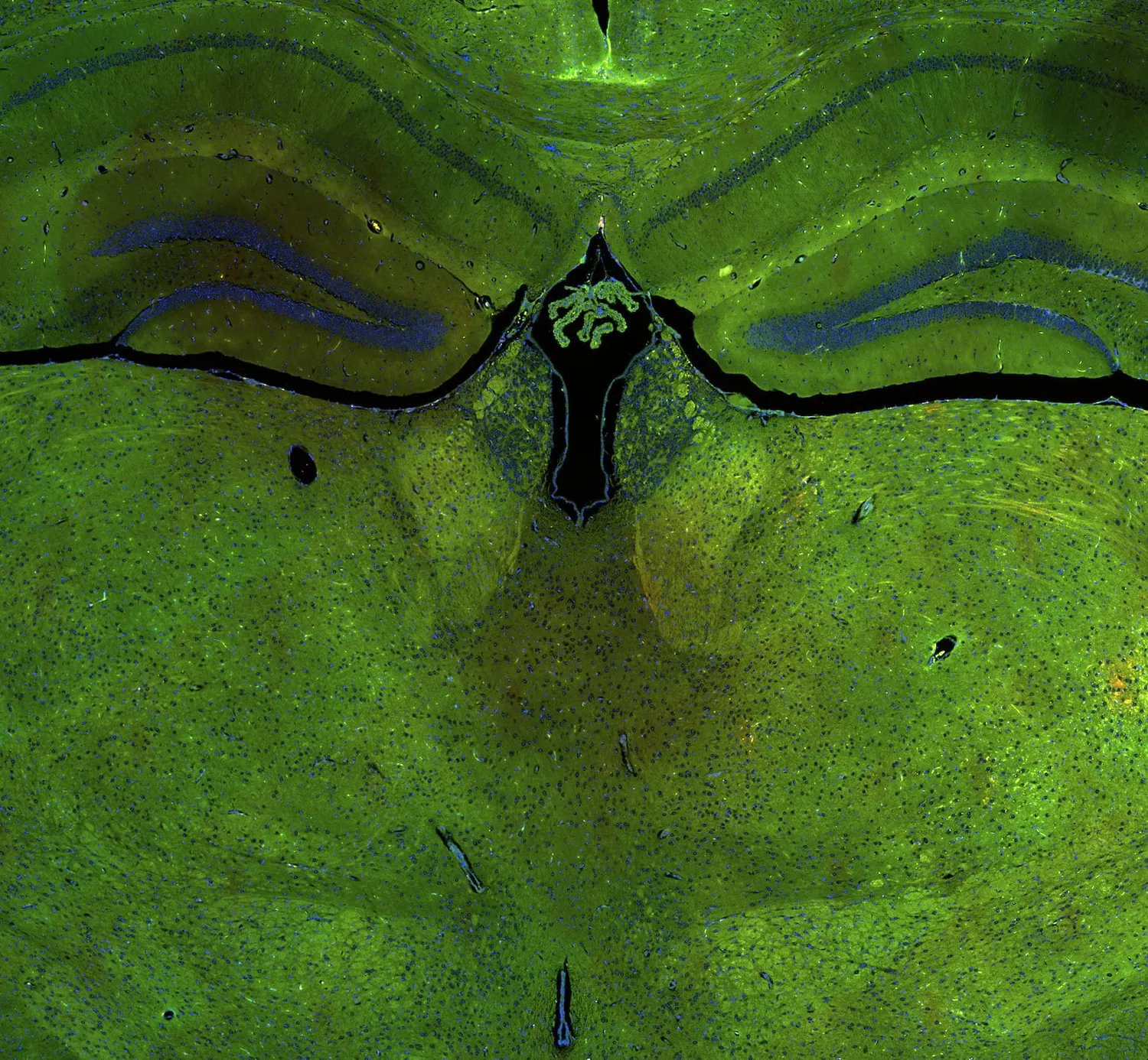 Immunofluorescence of a coronal brain section showing the hippocampus and thalamus in green with nuclei counterstained blue